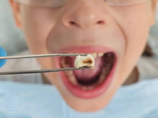 Best Emergency Dental Services for Seniors in Milford, DE